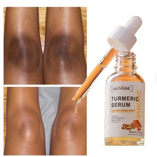 SauVasine Turmeric Serum - BelleHarris