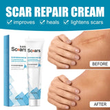 New Herbal Scar Repair Cream - BelleHarris