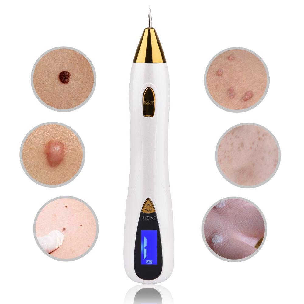 Skin Care Laser Mole Tattoo Freckle Removal - BelleHarris