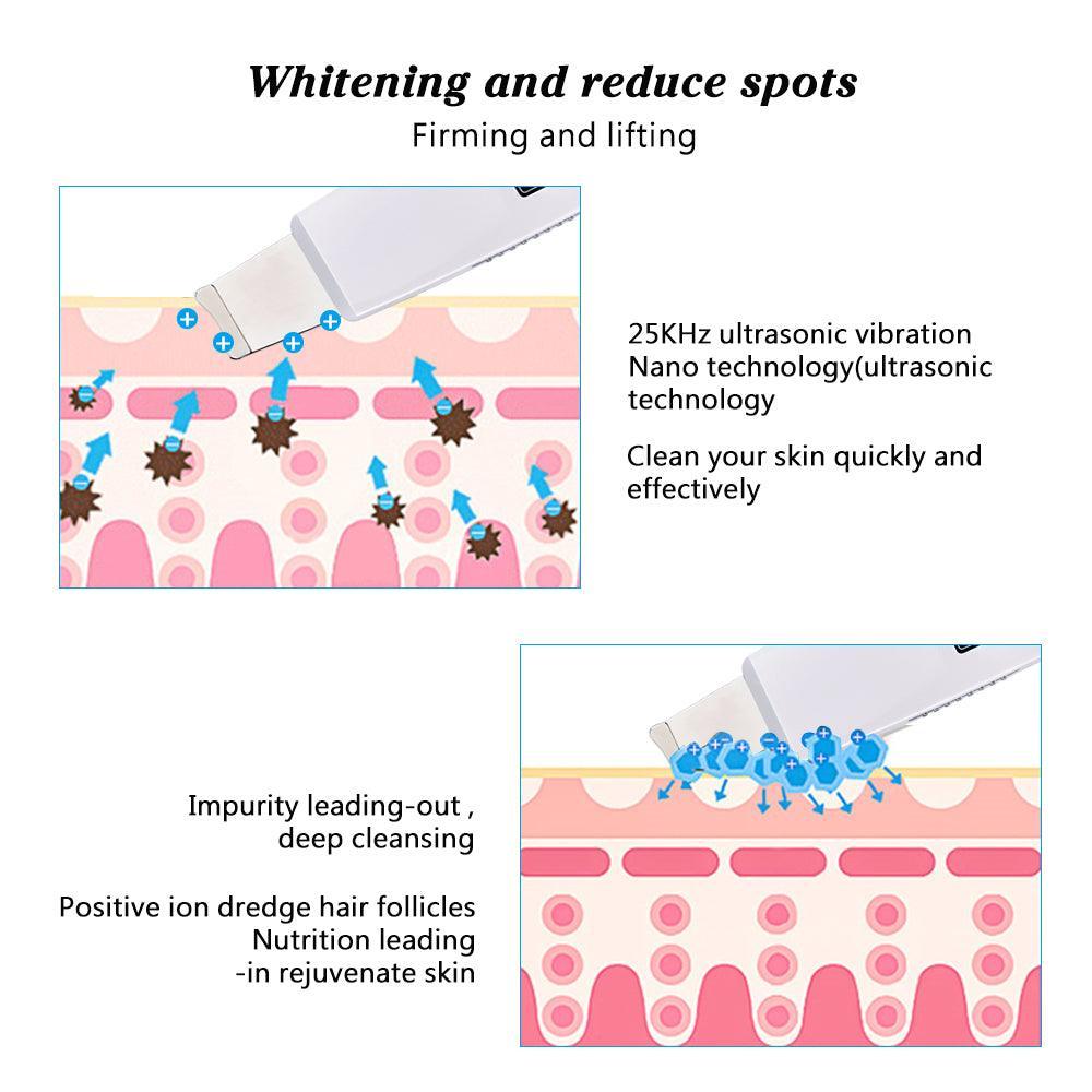 Ultrasonic Facial Skin Cleaner Exfoliating Pore - BelleHarris