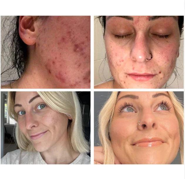 Advanced Snail 96 Mucin Power Essence - BelleHarris