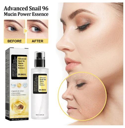 Advanced Snail 96 Mucin Power Essence - BelleHarris