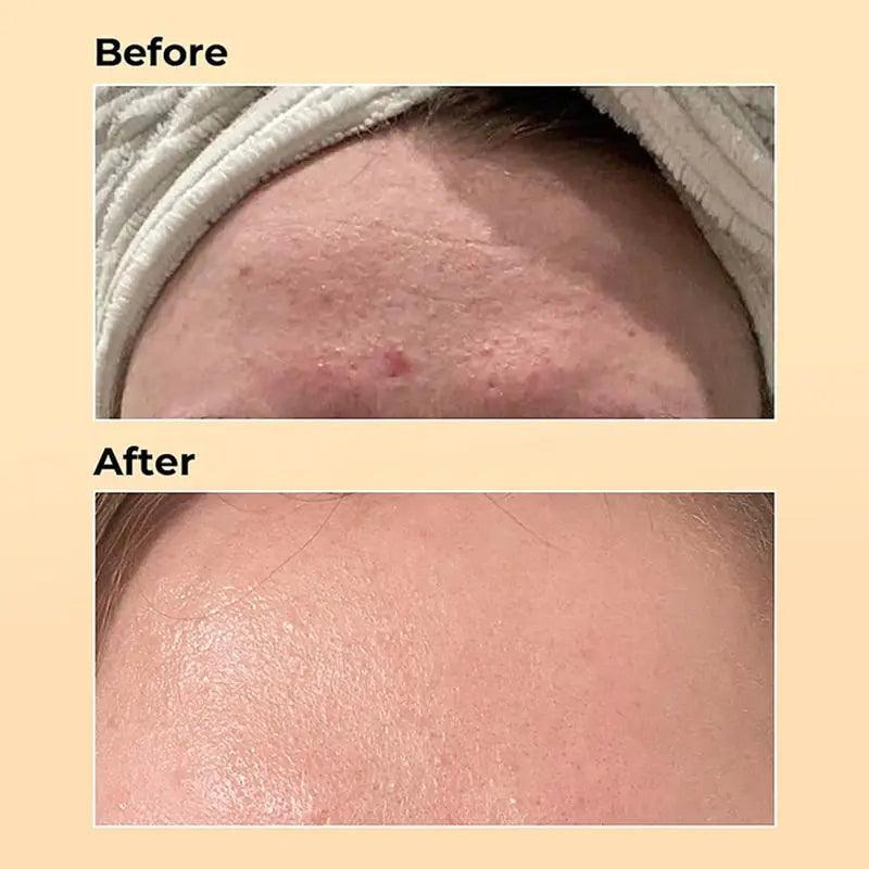 Anti-aging Fade Fine Lines Repairing Essence Serum - BelleHarris