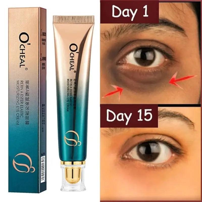 New Anti-Wrinkle Eye Cream - BelleHarris