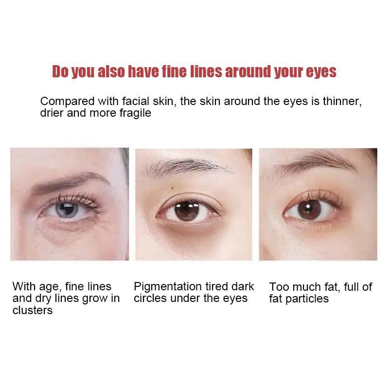 New Anti-Wrinkle Eye Cream - BelleHarris