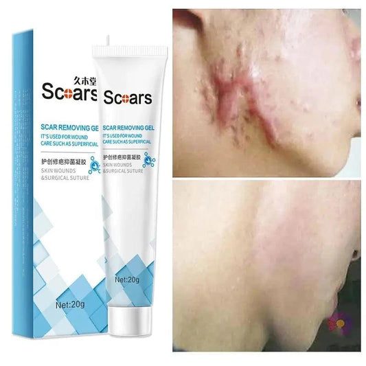 New Herbal Scar Repair Cream - BelleHarris
