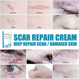 New Herbal Scar Repair Cream - BelleHarris
