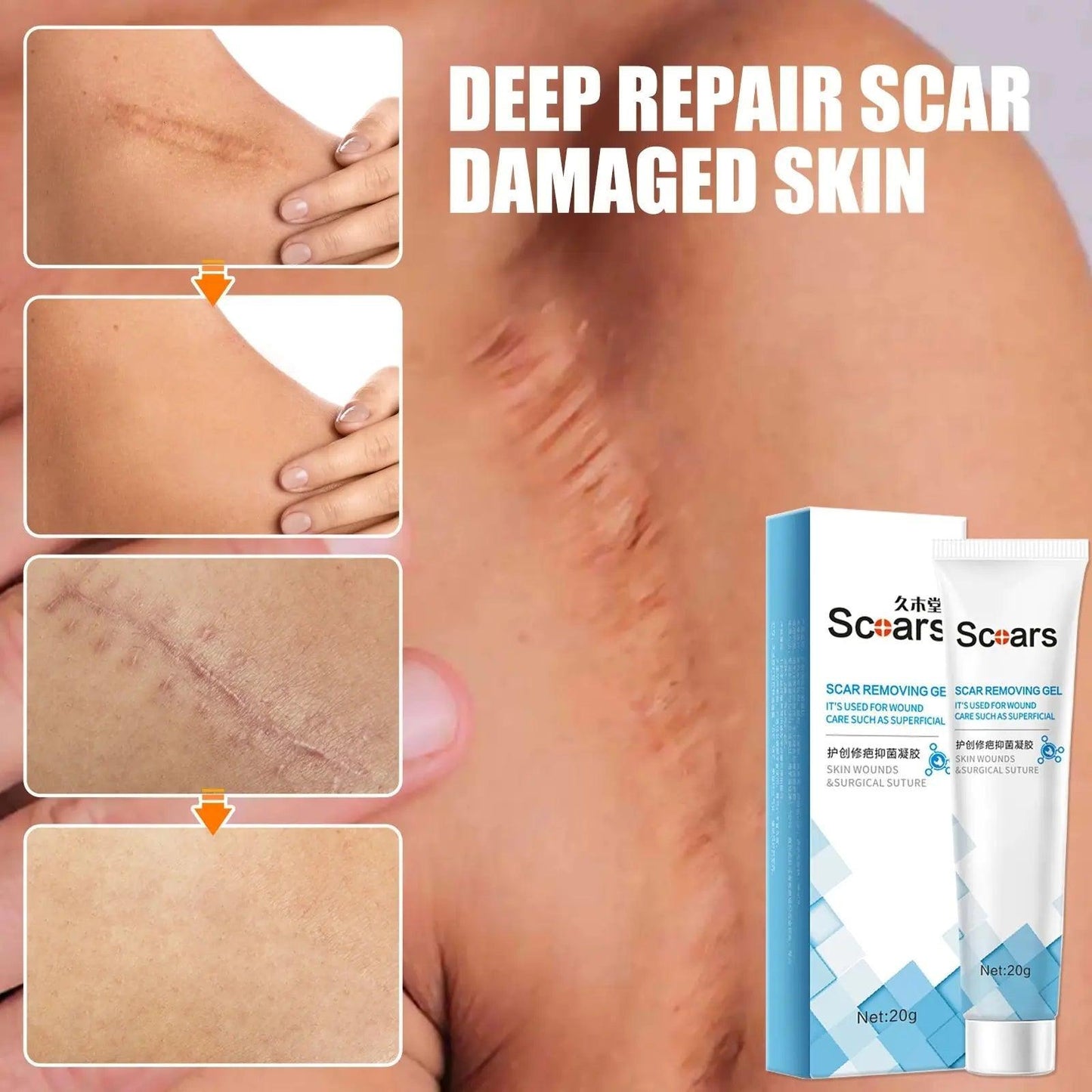 New Herbal Scar Repair Cream - BelleHarris