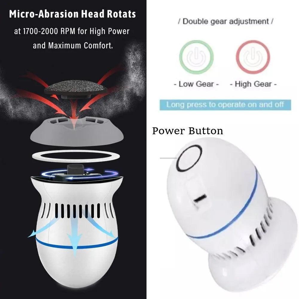 Vacuum Callus Remover - BelleHarris