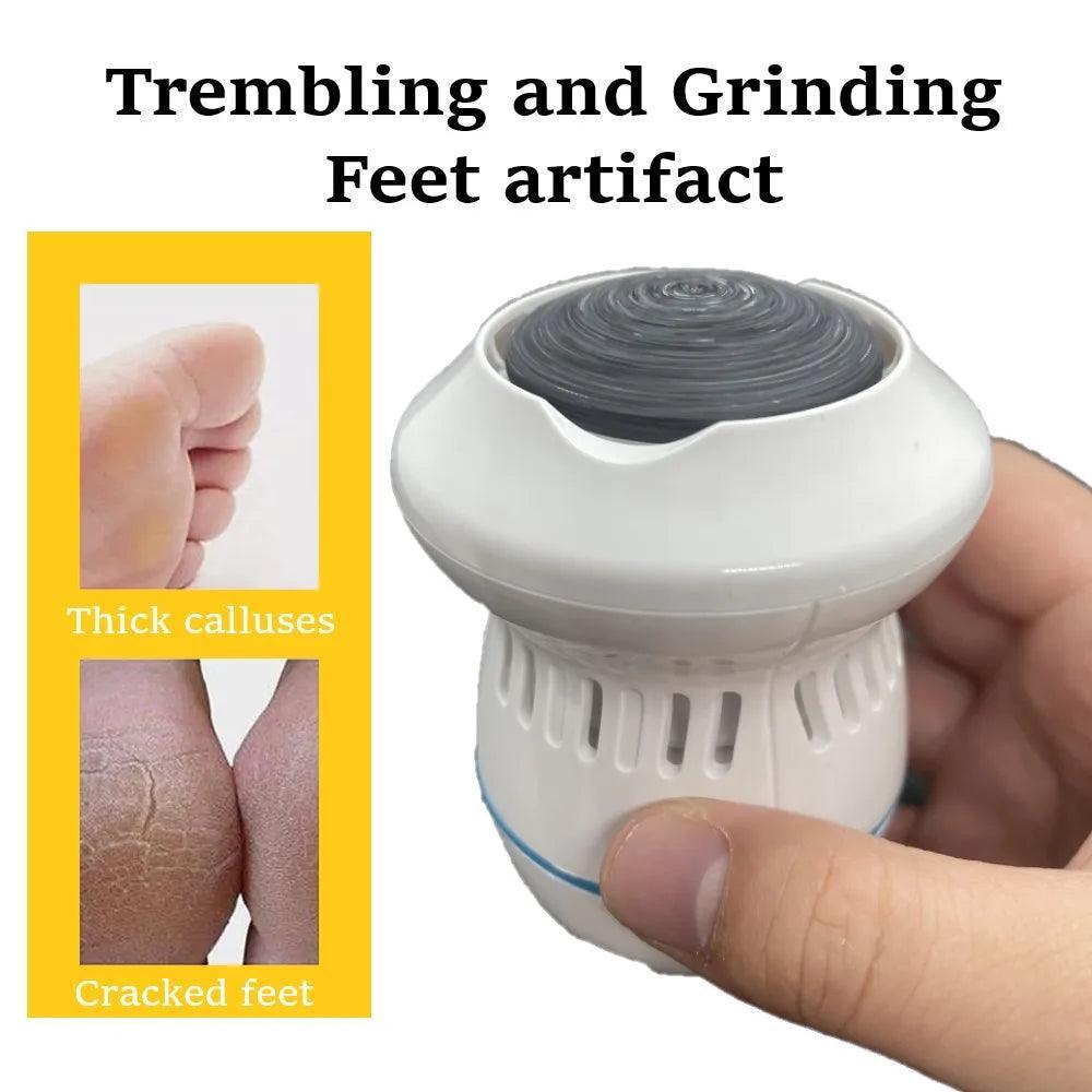 Vacuum Callus Remover - BelleHarris